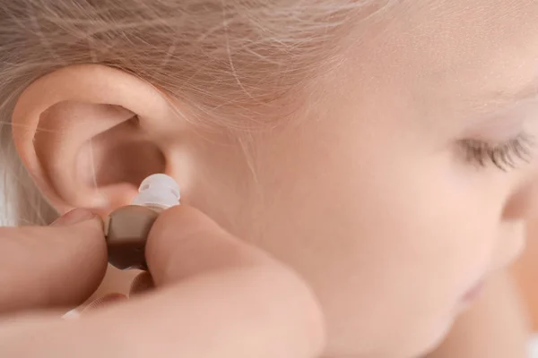 Woman Inserting Hearing Aid Ear Little Girl Closeup — Stock Photo, Image