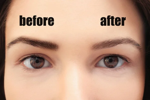 Wanita Sebelum Dan Sesudah Prosedur Laser Tato Penghapusan Closeup — Stok Foto