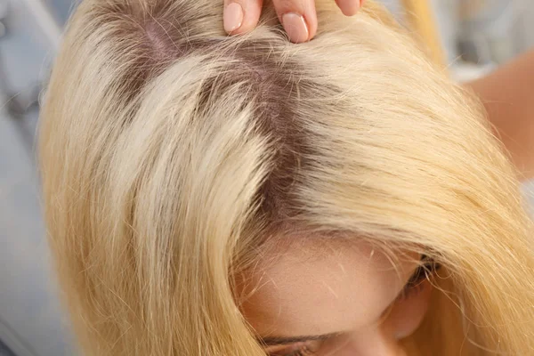 Žena Ukazuje Její Vlasy Regrowth Kořeny Blond Umírání Zblízka Ženské — Stock fotografie