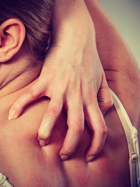 Problema Salud Enfermedades Piel Mujer Joven Rascarse Espalda Con Picazón — Foto de Stock