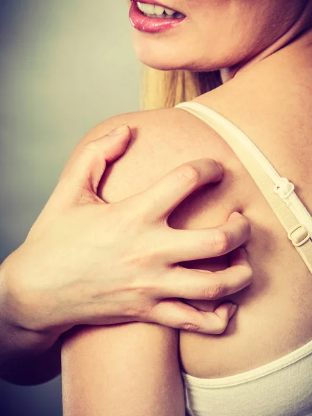 Health Problem Skin Diseases Young Woman Scratching Her Itchy Back — Stock Photo, Image