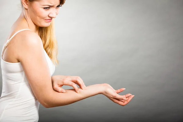 Dermatologie Allergie Und Gesundheitsprobleme Junge Frau Kratzt Ihren Juckenden Arm — Stockfoto