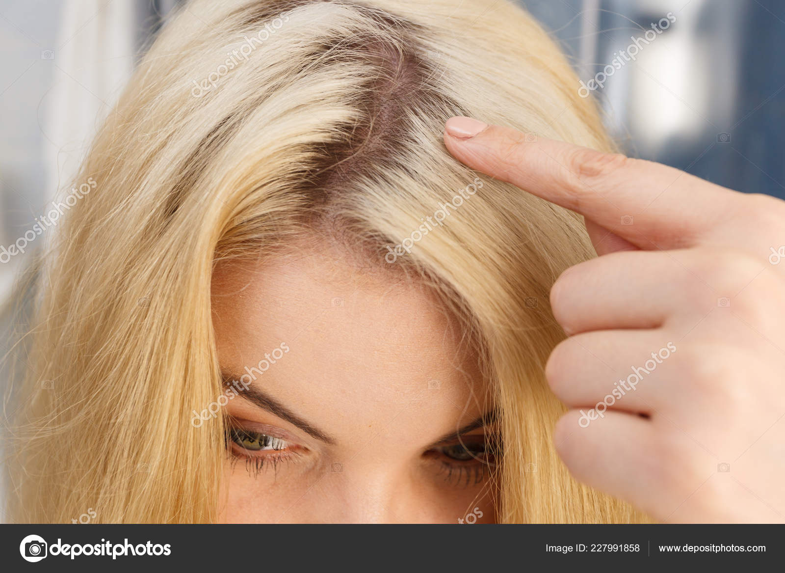 Woman Showing Her Hair Regrowth Roots Blonde Dying Close Female
