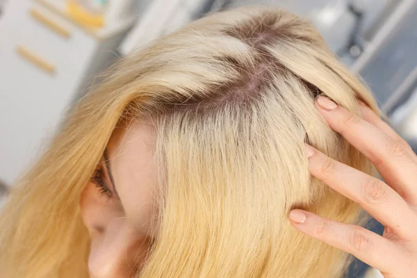 Woman Showing Her Hair Regrowth Roots Blonde Dying Close Female — Stock Photo, Image