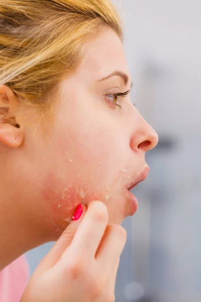 woman removing peel off mask from her face