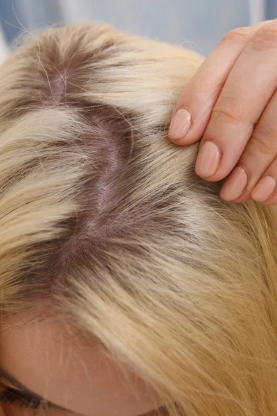 Woman showing blonde hair roots