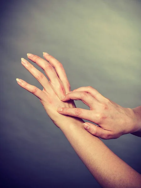 Weibchen kratzt ihre juckende Handfläche mit allergischem Ausschlag — Stockfoto