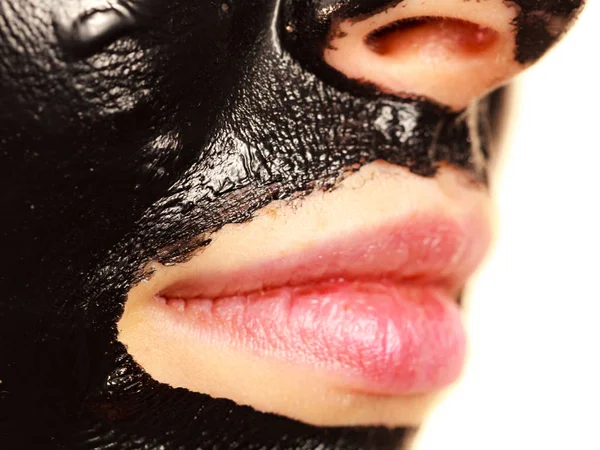 Girl black carbo peel off mask on face — Stock Photo, Image