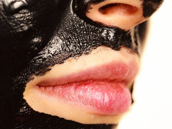 Young Woman Carbo Detox Black Peel Mask Her Face Detail — Stock Photo, Image