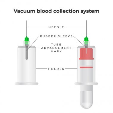 Vakum kan toplama sistemi infografik elemanları. Vakum kan tüpü, çift taraflı iğne, iğne tutucu - düz tasarım vektör illüstrasyon.