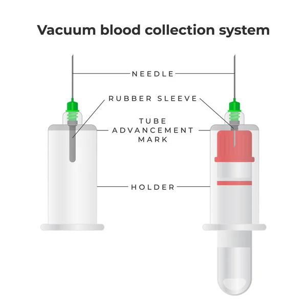 Sistema di raccolta del sangue sottovuoto elementi infografici. Tubo sanguigno sottovuoto, ago bifacciale, porta aghi - illustrazione vettoriale in design piatto . — Vettoriale Stock