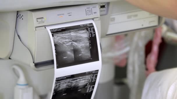 Ultrasound. Cardiology. Monitor screen close up. — Stock Video
