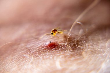 İnsan derisi kan emme sivrisinek Close-up