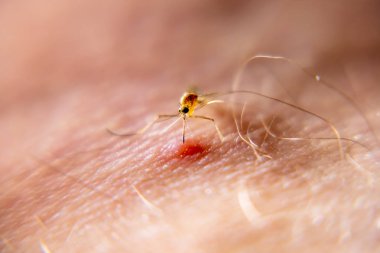 İnsan derisi kan emme sivrisinek Close-up