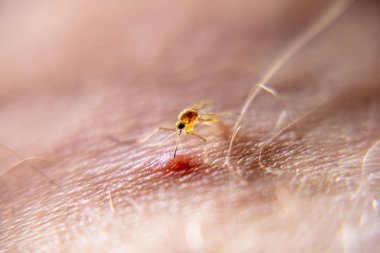 İnsan derisi kan emme sivrisinek Close-up