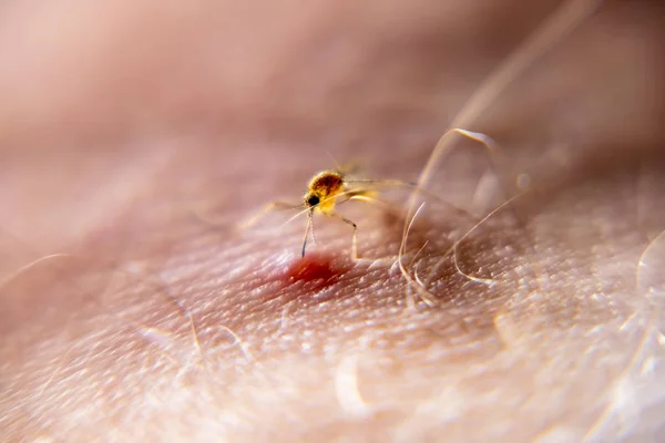 Primer plano de mosquitos chupando sangre de la piel humana — Foto de Stock