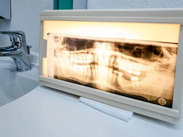 中年男性のパノラマ歯科X線写真 — ストック写真