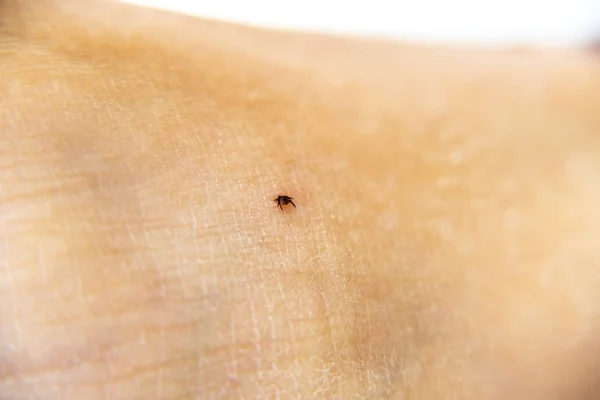 Vink op menselijke huid zuigen bloed uit been — Stockfoto