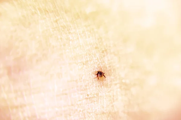 Tick on human skin sucking blood from leg — Stock Photo, Image