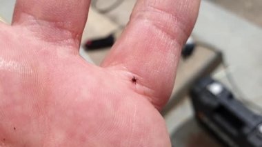 Kan emmek için iyi bir yer bulmak için insan derisi üzerinde tarama Tick