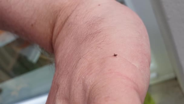 Tick crawling on human skin to find a good place to suck blood — Stock Video