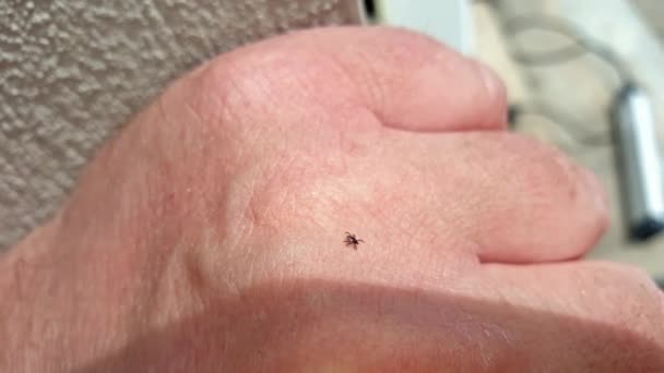 Tick crawling on human skin to find a good place to suck blood — Stock Video