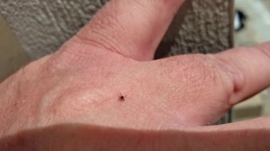 Kan emmek için iyi bir yer bulmak için insan derisi üzerinde tarama Tick