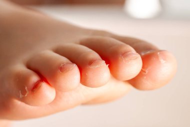 Kızların sağ ayağı ayak parmaklarının arasına kadar uzanıyor.