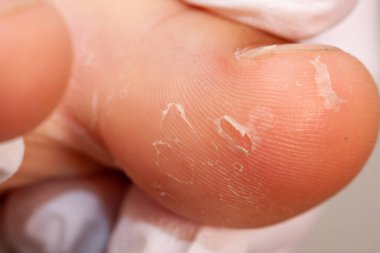 Doktor el küçük bir kızın ayağını muayene ediyor.