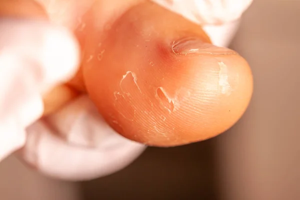 Dokter hand onderzoeken van een kleine meisjes voet — Stockfoto