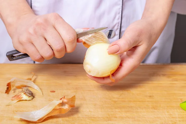 Cook Cleans Skin Onion Hands Close — Stock Photo, Image