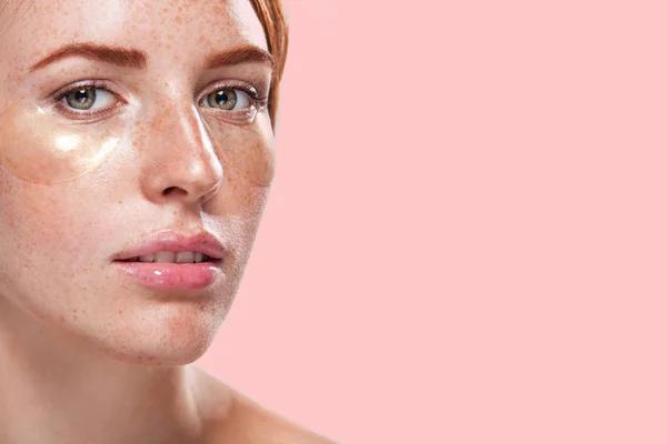 Beautiful model woman with ginger hair and frackles and closeup gold patches for skin care — Stock Photo, Image