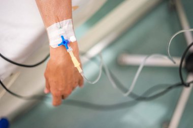 Genç beyaz bir kadın yandan periferik venöz kateter