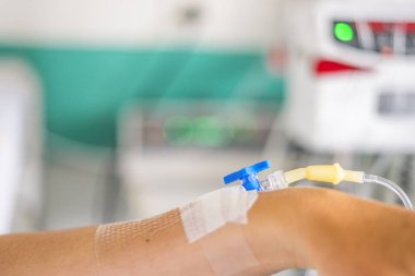 Genç beyaz bir kadın yandan periferik venöz kateter