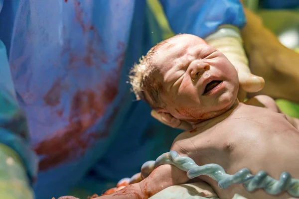 Neugeborener Junge Mit Nabelschnur Wird Von Hebamme Betreut — Stockfoto