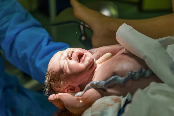 Neugeborener Junge Mit Nabelschnur Wird Von Hebamme Betreut — Stockfoto