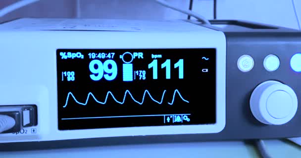 EKG EKG kórházi műtét működő sürgősségi szobában találat beteg pulzusszám, egészségügyi