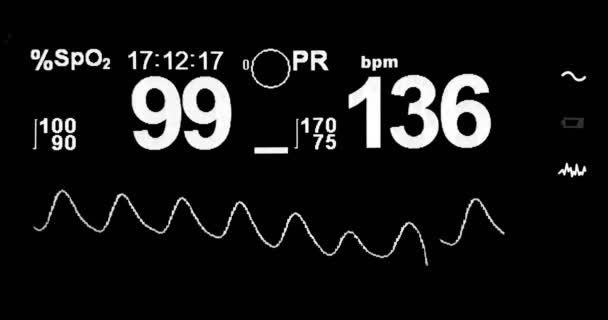 Symbole blanc graphique de l'électrocardiogramme ecg en chirurgie hospitalière salle d'urgence montrant la fréquence cardiaque du patient, soins de santé — Video