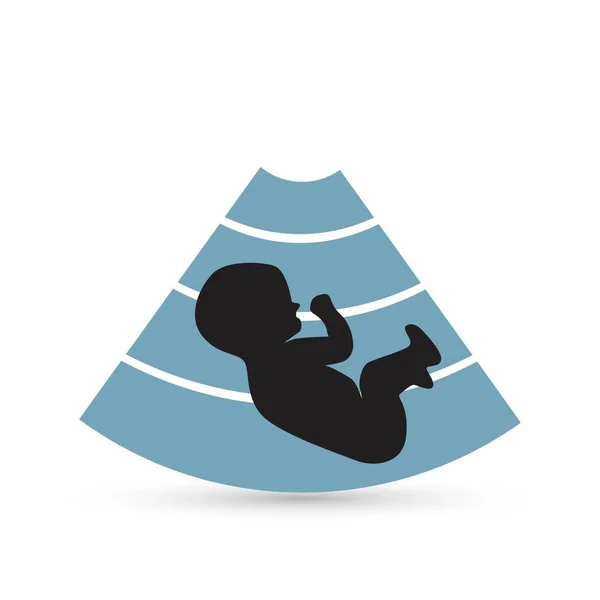 Ecografía del bebé, ecografía diagnóstica o imagen por ultrasonido icono plano — Vector de stock