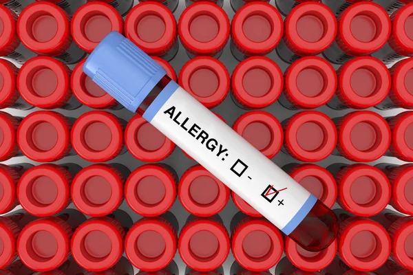 Пробирка для анализа крови с аллергией Положительный результат над рядами — стоковое фото