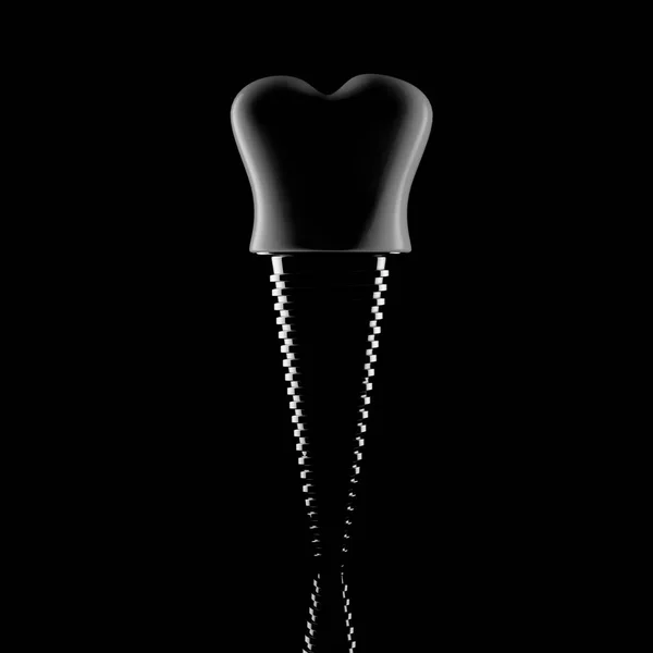 Zahnimplantat. 3D-Darstellung — Stockfoto