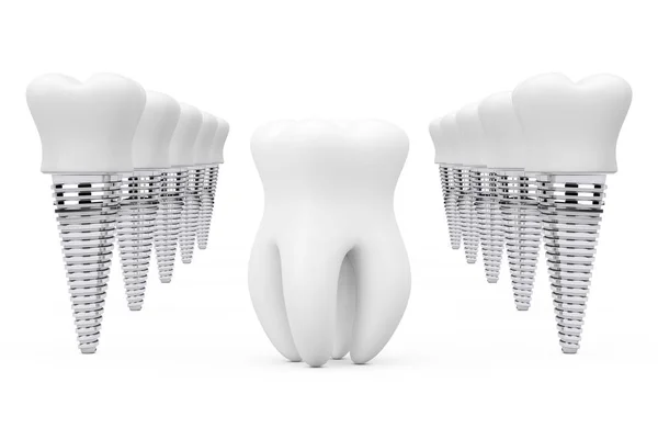 Dente saudável pré-molar entre linhas de implantes dentários. Render 3d — Fotografia de Stock