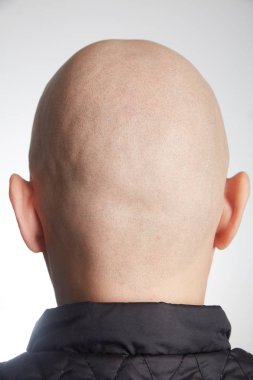 profesyonel dövmeci kalıcı hale getirme tricopigmentation kadar yapmak