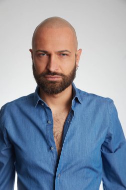 tricopigmentasyon tedavisi olan adam