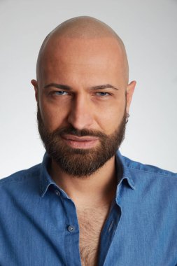 tricopigmentasyon tedavisi olan adam