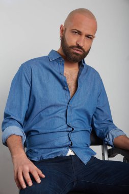 tricopigmentasyon tedavisi olan adam