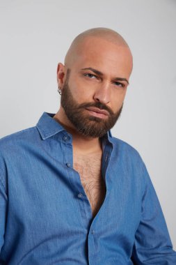 tricopigmentasyon tedavisi olan adam