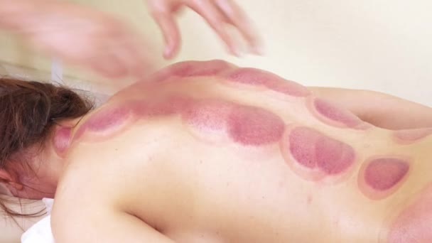 Massage durch medizinische Banken — Stockvideo