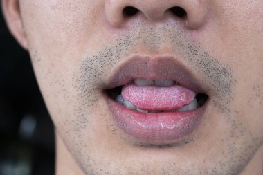 Close-up Sore tongue clipart