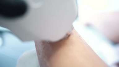 Elektrik epilatör aygıt. Hisse senedi. Kolundaki epilasyon cihazı. Saç çıkarma yordamı yandan salon de